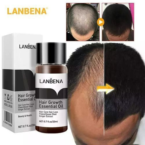 Lanbena Powerful Ginger Hair Growth Bald Head Find Lost Hair 20ml