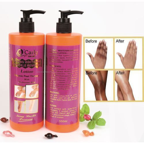 One Piece OfStrong Knuckle Remover Lotion With Hyaluronic Acid 550ml